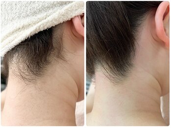 ベルネージュ(Belle Neige)/