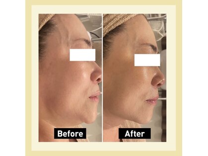 アユーラの写真