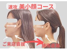小顔×骨格専門サロン/小顔骨格ボディメイク￥10000