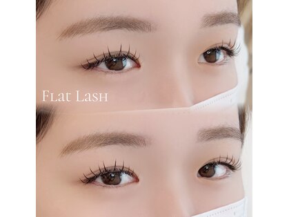 リリー(LILY)の写真