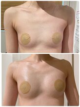 ルナグランデ(Luna grande.)/新脂肪増加剤10ml導入♪