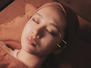 タオ 京都烏丸(TaO)/美容鍼