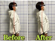 幸鍼灸整体院 武庫之荘院/整体・トレーニング・姿勢変化3