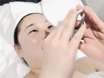 テッコ(TeCCO)/施術途中にお肌確認!感動~