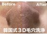【1ヶ月以内に再来のお客様】話題沸騰◇韓国式3D毛穴洗浄 17,600円→12,800円
