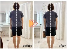 ラフィング(Laughing)/産後