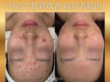 ハウピア 烏丸(Haupia)/