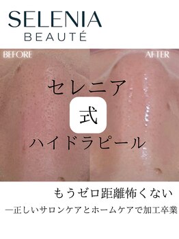 セレニア ボーテ(Selenia Beaute)/