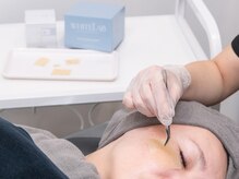 ウルト(ULT)/ホワイトラボ