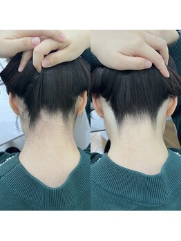 ミース 長野店/うなじ矯正◆ビフォーアフター