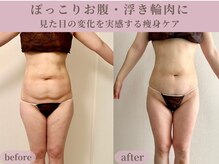 ティターニア(Titania)の雰囲気（ぽっこりお腹/年齢とともに落ちにくいお腹周りを集中ケア☆）