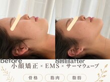 エスポワール(espoir)の雰囲気(最短8回で劇的小顔!同時にハーブピーリング・ララピールも◎)