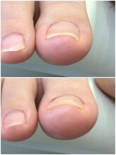 モアクリスタル(More Crystal)/