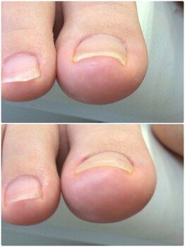 モアクリスタル(More Crystal)/