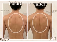 アンバー 恵比寿(AMBER)/凝り固まった肩甲骨周りスッキリ