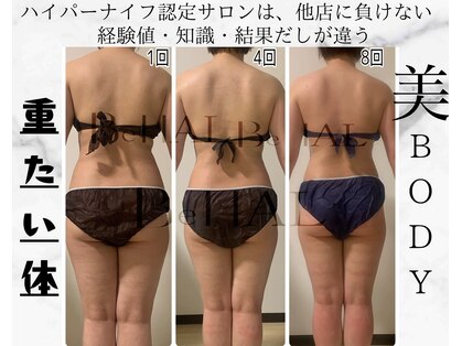 ビナル(BeNAL)の写真