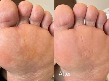 キラネイル アンド アイラッシュ by World Beauty(KIRA)/新潟フット角質除去