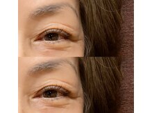 オーバイルッカ(O by RUCCA)/瞼避けながらUP