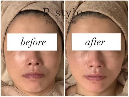 エステサロン アールスタイル(R-style)の写真