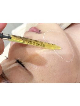 ホウレイ線・たるみ改善！予防ケア