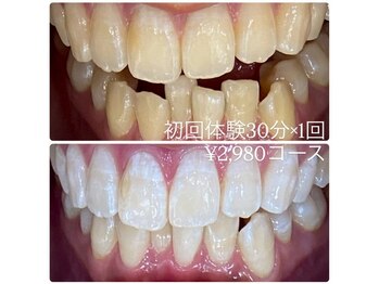 ホワイトニングルーム 横浜店(Whitening Room)/セルフホワイトニング/横浜