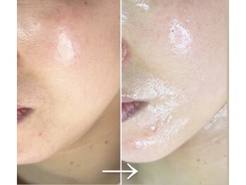 ロイヤル ビューティー サロン(Royal Beauty Saloon)/韓国発最新肌管理【セルマン】