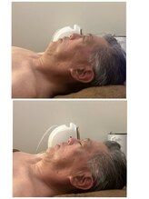 吉川美南ライフ整骨院/60代男性