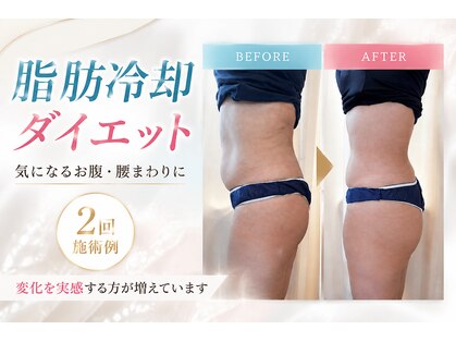リラクゼーションサロン ラー 金沢店(Ra)の写真