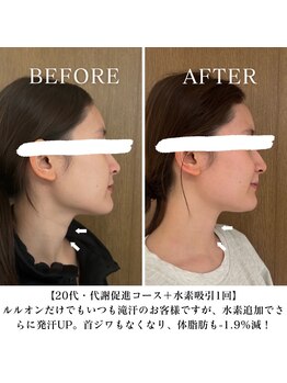 ヨサパーク スリー 西日暮里(YOSA PARK three)の写真/水素で発汗を促進し、むくみ顔スッキリ♪顎の気になるたるみもお肌トラブルにも