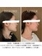 ヨサパーク スリー 西日暮里(YOSA PARK three)の写真/水素で発汗を促進し、むくみ顔スッキリ♪顎の気になるたるみもお肌トラブルにも