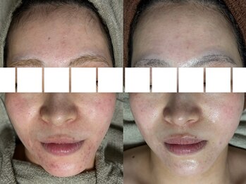 リボーン(REBORN)/幅広い年齢層から大人気のハーブ