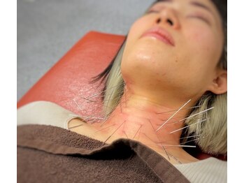 船橋はりきゅう整骨院/ルート鍼/整体/腰痛/マッサージ