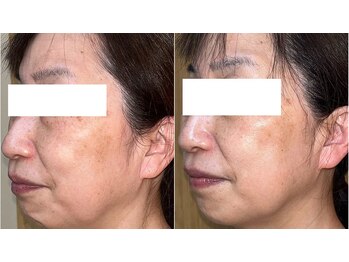 タンカルム(TempsCalme)