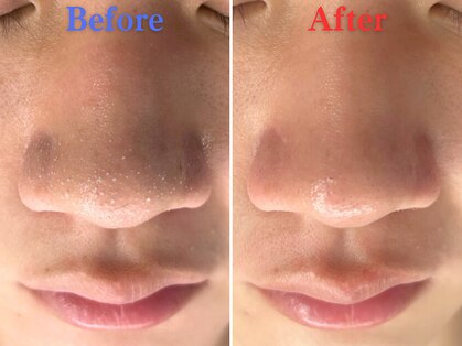 ボーンオム(Born Homme)の写真