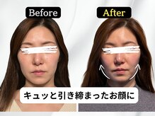 ハリユナイテッド 原宿鍼灸 整体院(HALI UNITED)