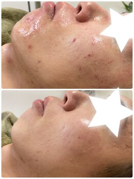 イネスプライベートスペース(Ines)/男性も通われています