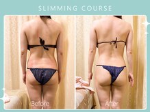 ハノハノ 八代店(HANO HANO)/選べる12種の痩身脂肪撃退☆