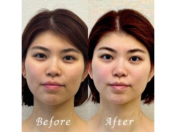 ブリーズベール(BRISE VERT)の写真/ここぞという特別な日のためのスペシャルな1日!完全個室オールハンドで毛穴・たるみケア♪