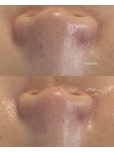ベルーナビューティ 西新宿(Beluna beauty)/