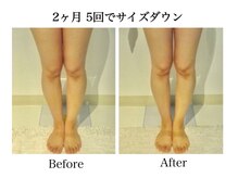 ナチュラーレ 天王寺店(Naturale)/痩身リンパマッサージ二の腕美脚