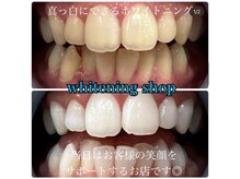 ホワイトニングショップ 柏店/美白ホワイトニング