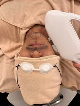 カピリナ(kapilina)/ヒゲ脱毛