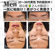 キレイラボ(Ki-Re-i LABO)