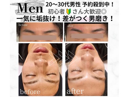キレイラボ(Ki-Re-i LABO)の写真