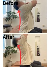 リライフ/Before/After