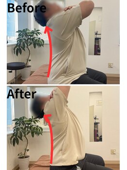 リライフ/Before/After