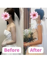 ボディキュア ブライダル美容整体 大阪梅田/写真映えする姿勢とは？/北新地