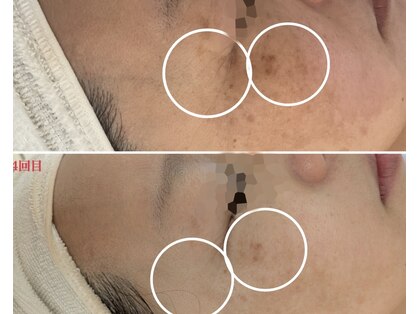 サロンドットブレスドットケイ(salon.bless.k)の写真