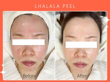 シロカネ イオンタウン西熊本店(SHIROKANE)/韓国肌管理ララピール☆