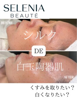 セレニア ボーテ(Selenia Beaute)/